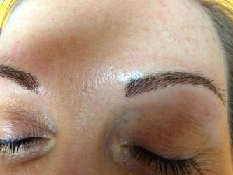 Augenbrauen vor der Abheilung