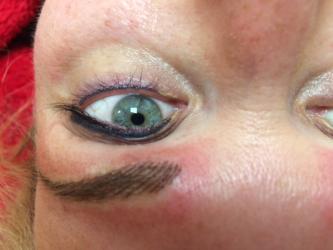 Augenbrauen/ Lidstriche vor der Abheilung