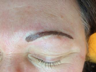 Augenbrauen vor der Abheilung